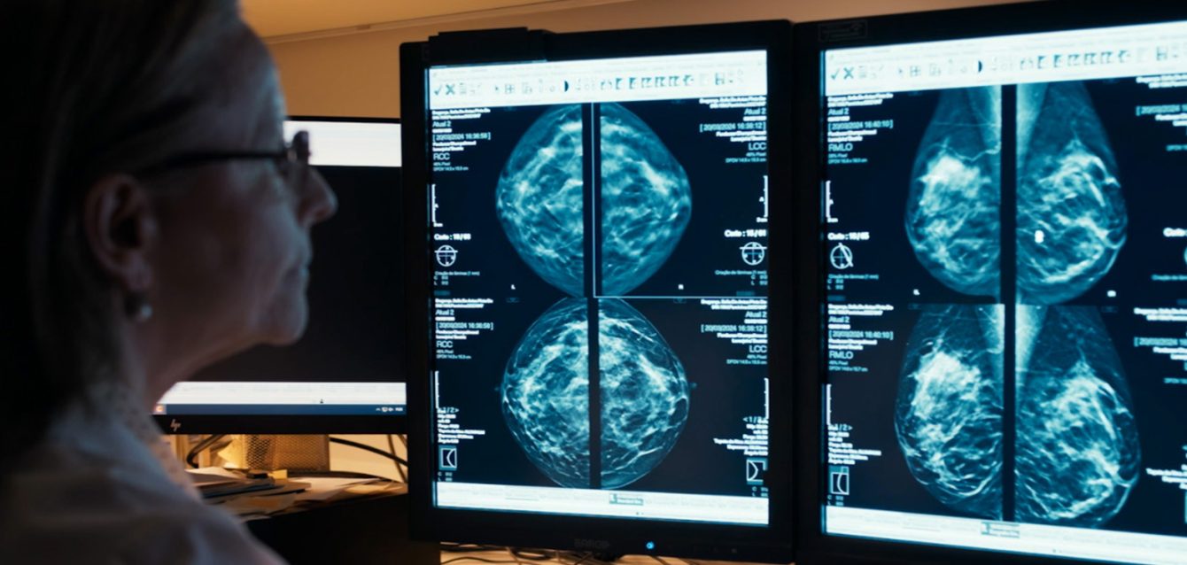 Breast-Imaging